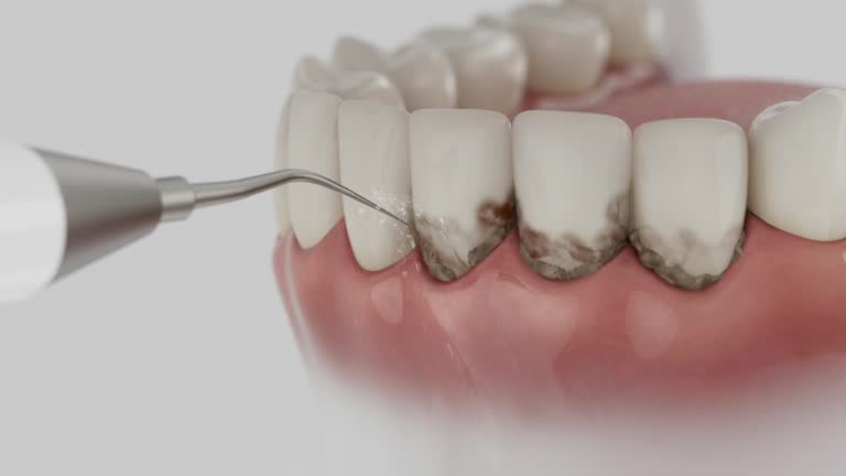 Trusted Root Canal Treatment service in New Cumberland, WV - Dentist Open Now